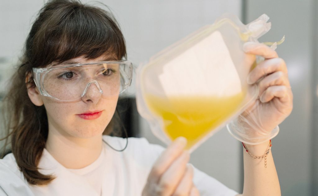 a woman holding a plastic container with plasma inside