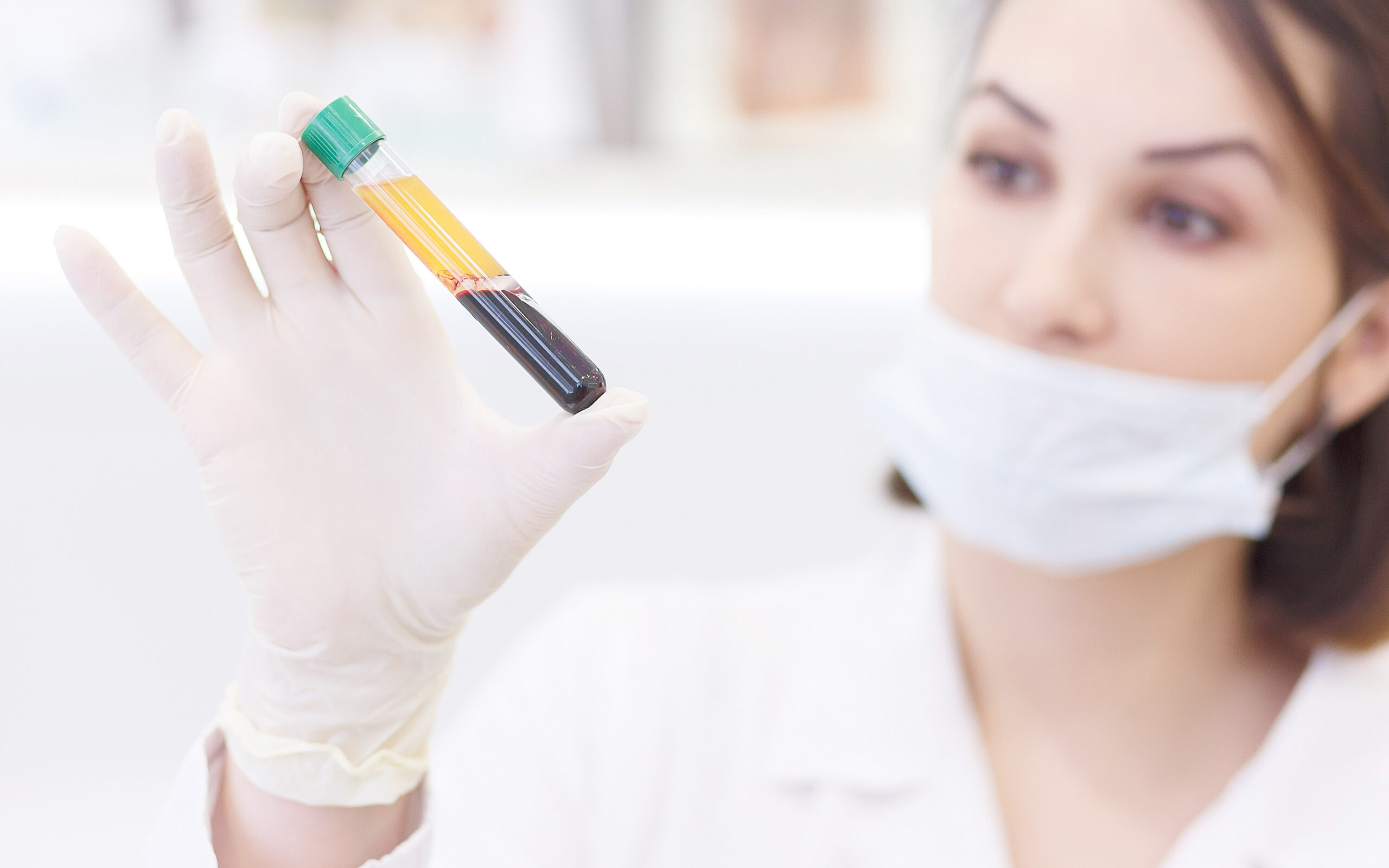 nurse holding a plasma sample