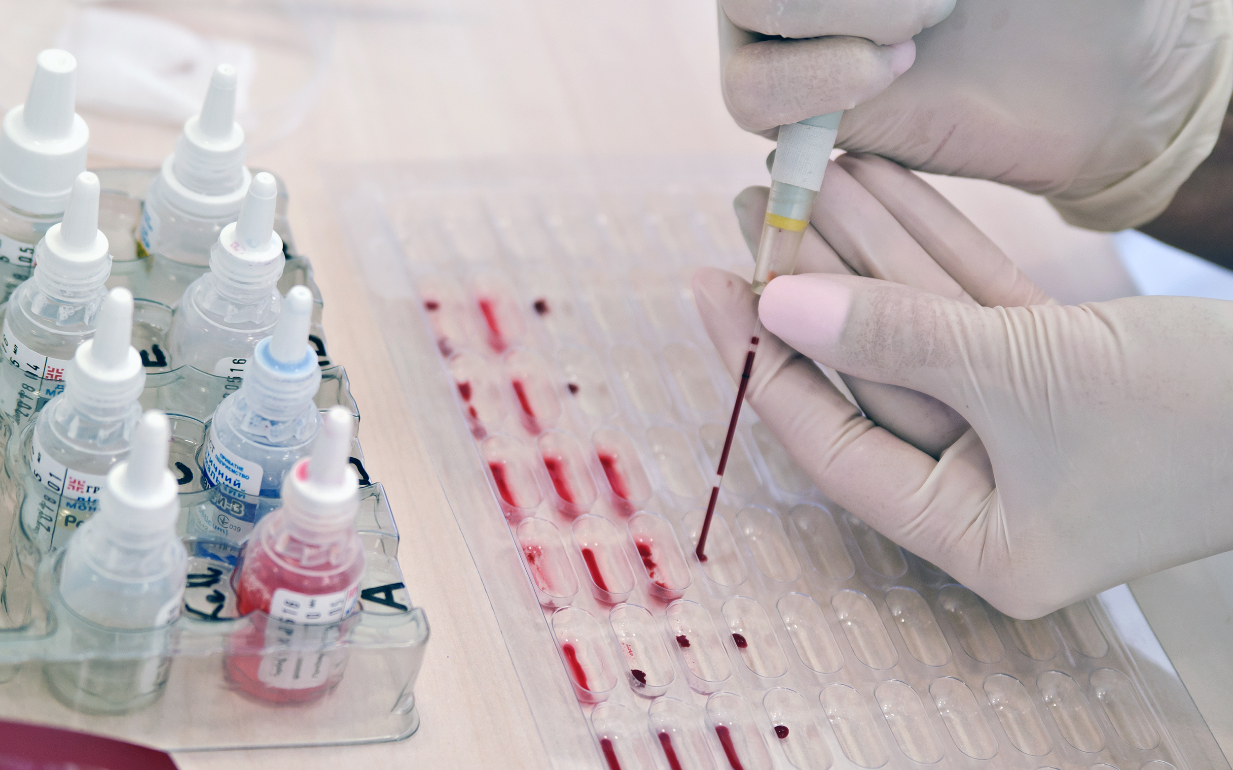 donated plasma samples